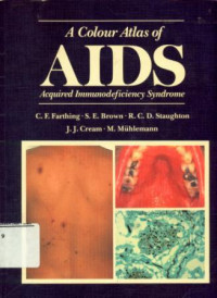 A Colour Atlas of AIDS Acquired Immunodeficiency Syndrome