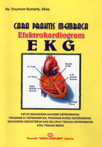 Cara Praktis Membaca Elektrokardiogram EKG