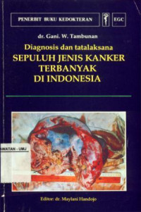 Diagnosis dan Tatalaksana Sepuluh Jenis Kanker Terbanyak Di Indonesia