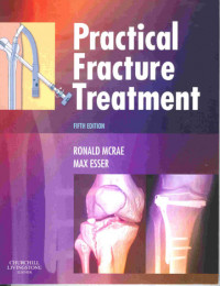 Practical Fracture Treatment Fifth Edition